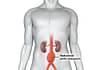 abdominal-aortic-aneurysm