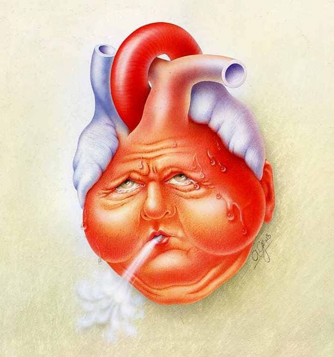heart-failure